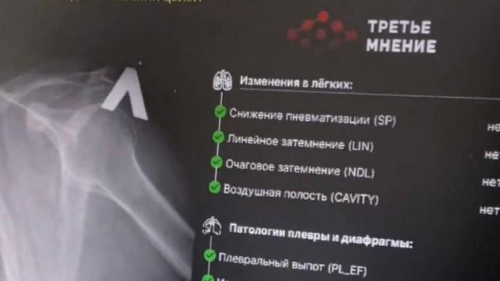 Нацпроекты: в Турках ИИ будет помогать врачам анализировать флюорографию