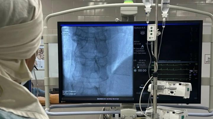 В Энгельсской больнице №2 начали применять внутрисосудистое УЗИ при операциях на сердце